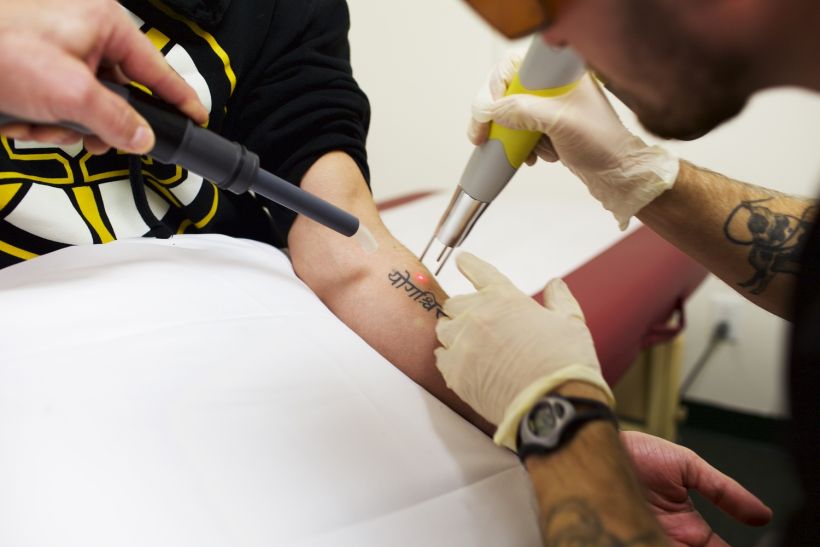 Erased Laser Tatoo Removal Tattoo Removal for Ex-Gang Members