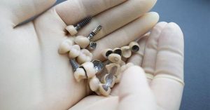 free dental implants grants